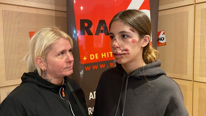 À Calais, un appel à témoins lancé pour retrouver le chauffard qui a renversé une lycéenne de 15 ans !