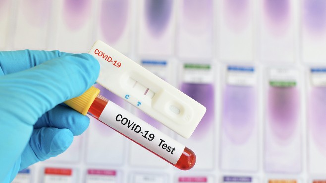 Ecuires : 1000 personnes testées au Covid lundi