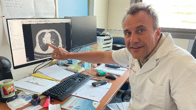 Lancé dans la Somme, le dépistage précoce du cancer du poumon pourrait s'étendre au niveau national
