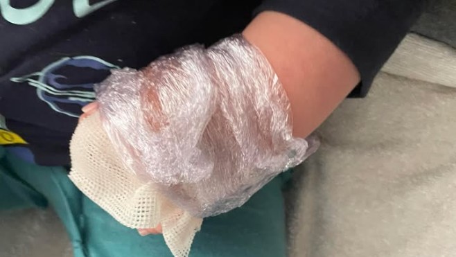 A Outreau, un enfant de 3 ans s’est brûlé à l’eau chaude en se lavant les mains dans un Flunch.