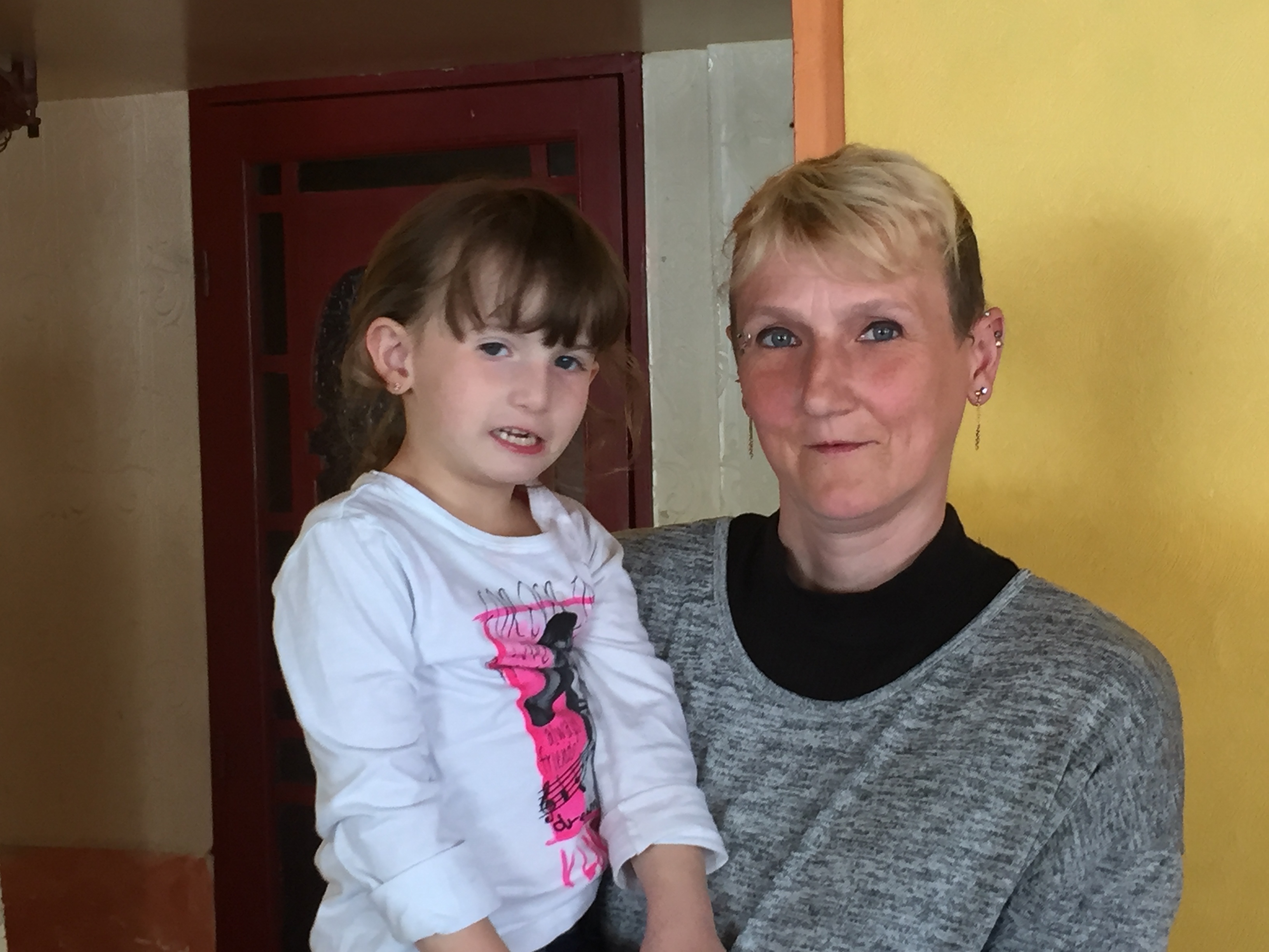 Appel aux dons pour Abygaelle, petite calaisienne de 4 ans atteinte du syndrome de Silver Russel, une maladie orpheline. 