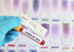Ecuires : 1000 personnes testées au Covid lundi 