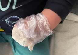 A Outreau, un enfant de 3 ans s’est brûlé à l’eau chaude en se lavant les mains dans un Flunch. 