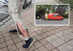 Calais: un enfant de 12 ans attaqué par 2 chiens, un Calaisien s'interpose en héros